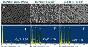 Mussel Polymers, Inc. announces breakthrough in the treatment of sensitive teeth