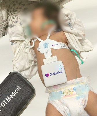 QT Medical announces FDA clearance of PCA 500, a resting 12-lead ECG (EKG), for use in pediatric patients.