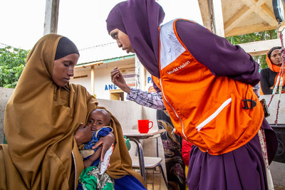 World Vision frontline staff are witnessing more children going hungry and becoming severely malnourished as the food situation across Somalia worsens amid fears of heightened risk of famine in some parts of the country. ©2022 World Vision