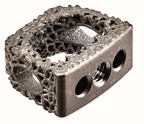 ulrich Medical USA™ Receives 510(k) Clearance for Flux-C™ 3D Printed Porous Titanium Cervical Interbody Prior to NASS