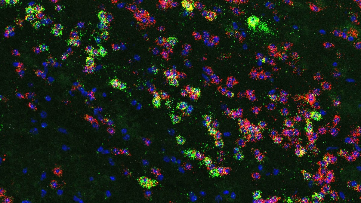 Got junk food on the brain? These cells may be to blame - Vimarsana News