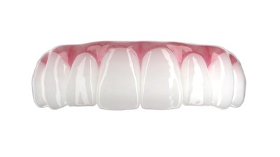 Yes, this was 3D printed. Printed dental prosthetic using SprintRay OnX Tough.