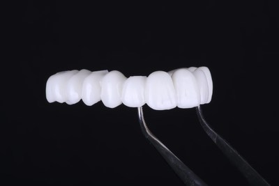 A dental prosthetic 3D printed using OnX Tough. Image courtesy Keith Klaus, DMD.