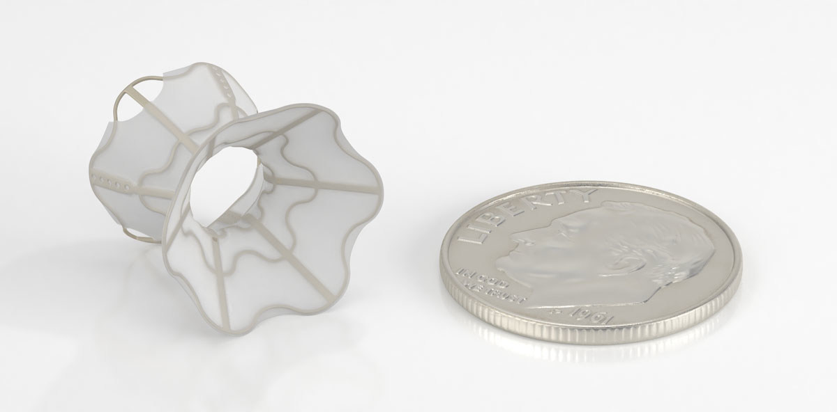 V-Wave Completes Enrollment in the RELIEVE-HF Randomized Double-Blind Controlled Trial of Interatrial Shunting for Heart Failure