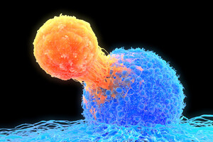 Von Turn Biotechnologies behandelte T-Zellen zeigen eine erhöhte krebstötende Wirksamkeit