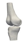 RSIP Vision Presents Successful Preliminary Results from Clinical Study of 2D-to-3D Knee Bones Reconstruction
