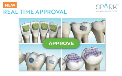 Spark™ Clear Aligners Release 13 includes Real Time Approval in the Spark Approver Software