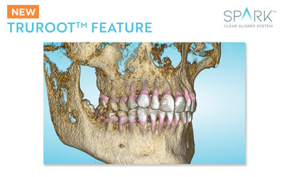 Spark™ Clear Aligners Release 13 includes CBCT TruRoot™ Feature