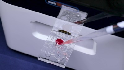 RheoMeditech to Showcase “Automatic Platelet Function Analyzer (ANYSIS)” and “ESR system (RheoESR)” at MEDICA 2022