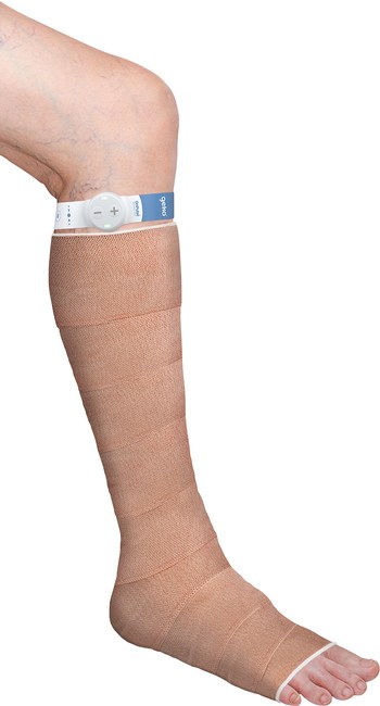 The geko™ device on the leg