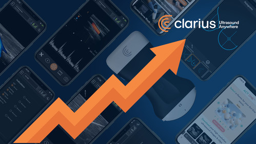 Clarius Mobile Health closed a record high fiscal year in 2022, growing sales of its New HD3 handheld wireless ultrasound scanners by 44% over the same period last year. Clarius Mobile Health closed a record high fiscal year in 2022, growing sales of its New HD3 handheld wireless ultrasound scanners by 44% over the same period last year.