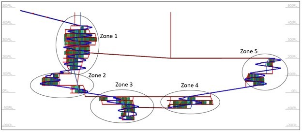 Global Atomic - Zones 1 to 5 schematic (CNW Group/Global Atomic Corporation) Global Atomic - Zones 1 to 5 schematic (CNW Group/Global Atomic Corporation)