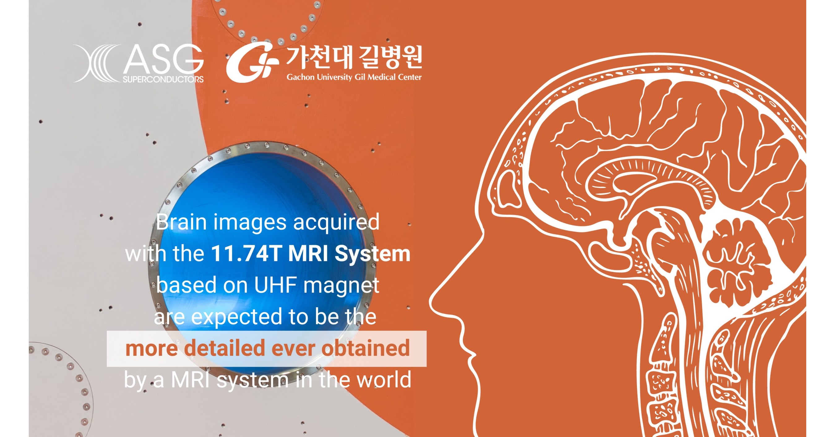 In operation the most innovative 11.74T MRI Core Magnet to be used on ...