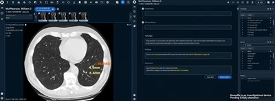 Sirona Medical Demo Video