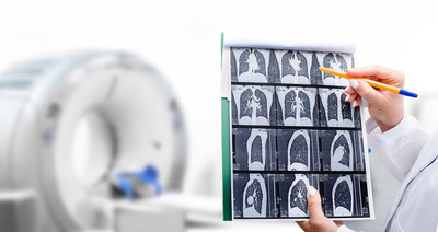 Olympus Corp. of the Americas and the American Lung Association are spotlighting potentially lifesaving lung cancer screenings during Lung Cancer Awareness Month.