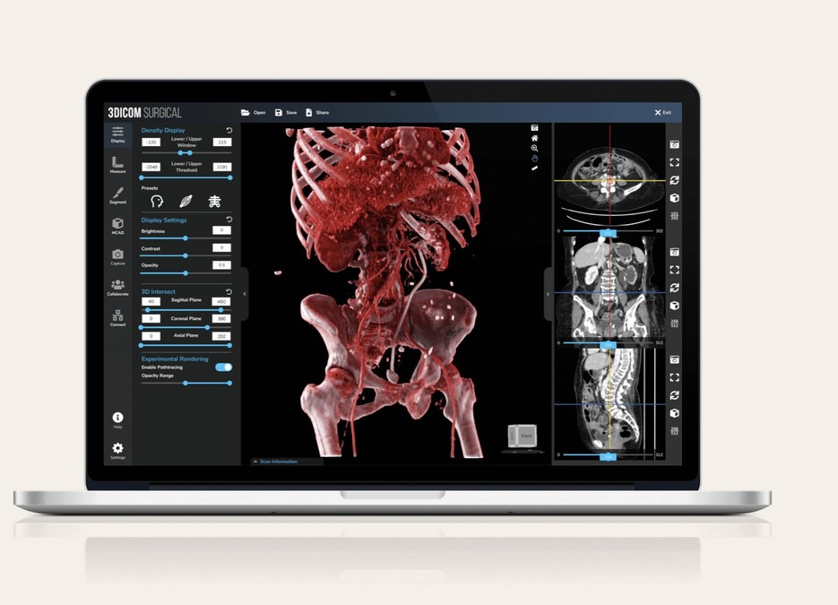 Coral Gables-based CG1 Solutions Selected to Join Singular Health's Partner Program to Market Australian Company's 3Dicom in the U.S. - Vimarsana News