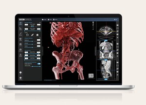 Coral Gables-based CG1 Solutions Selected to Join Singular Health's Partner Program to Market Australian Company's 3Dicom in the U.S.
