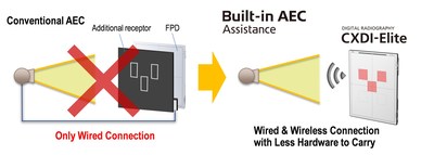 New Built-in AEC Assistance technology for digital radiography