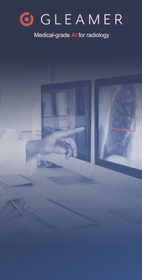 Radiologists are joining the AI revolution with early acceptance and adoption of BoneView by GLEAMER