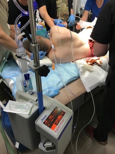 Severely injured soldier being treated with The Belmont® Rapid Infuser
