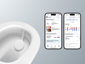 Withings Announces U-Scan - The World's First Hands-free Connected Home Urine Lab