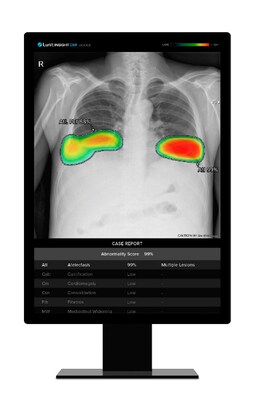 Lunit INSIGHT CXR, Lunit's AI solution for chest x-ray image analysis