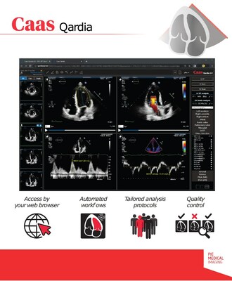 The novel PMI echocardiography software platform