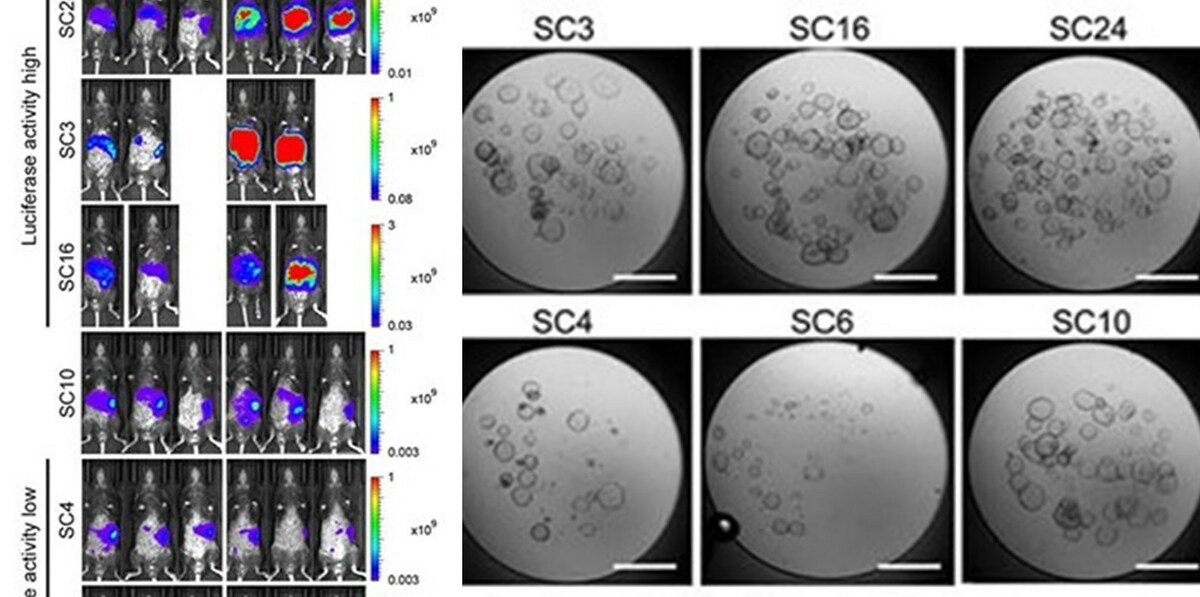Kanazawa University research: Cancer biology: Some cancer cells can lose their capability to migrate - Vimarsana News
