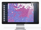 Lunit Highlights the Effectiveness of AI in Predicting Cancer Treatment Outcomes - Findings to be Presented at ASCO GI 2023