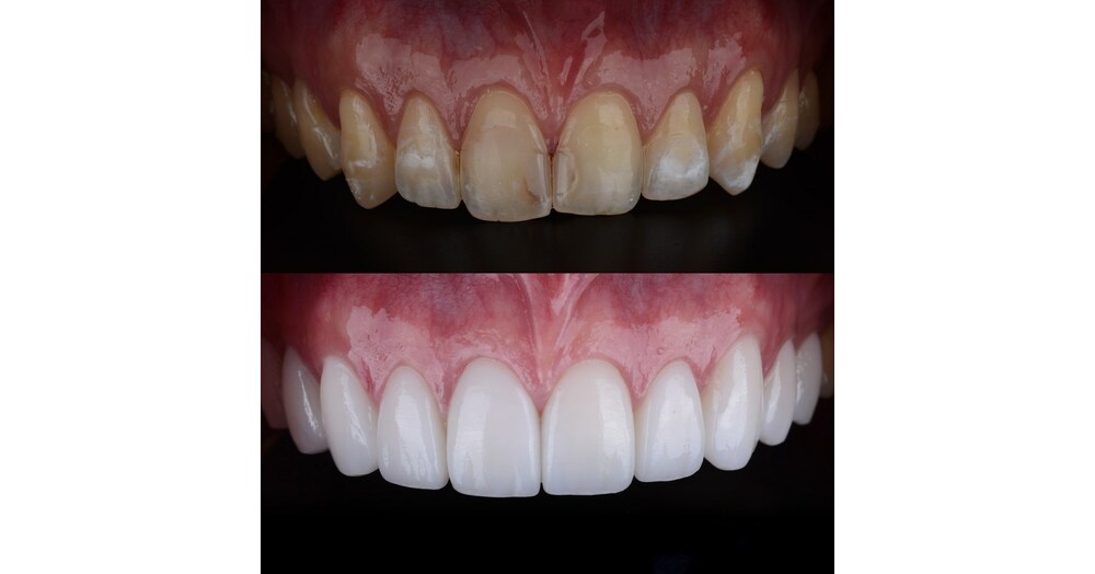 Celebrity Dentist Dr. Catrise Austin Joins Montclair Dental Spa To Offer New Smiles With