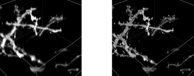 Left: Image acquired using AX R; Right: Image acquired using a combination of AX R and NSPARC. Optically cleared mouse brain, dendritic spines imaged at a depth over of 80 µm. Courtesy of: Lin Daniel, Ph.D., SunJin Lab Co.