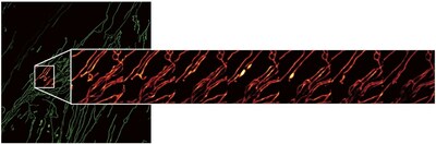 Live cell timelapse image of mitochondrial dynamics acquired using a combination of AX R and NSPARC. One area of the large field of view (left) is enlarged to show every tenth frame of a fast acquisition timelapse image (right).