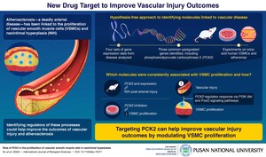 Atherosclerosis, Vascular Injury, and the Hunt for Drug Targets: Pusan National University and Korean Researchers' New Findings