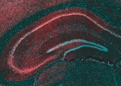 This microscope image of the brain region called the hippocampus shows the protein targeted by cannabis-derived CBD, GPR55 (red), and brain cells (blue) that send their extensions out to form the layers seen in the image. The interconnected nature of the hippocampus makes it a major site of for the initiation and spread of seizures. Tsein et al. Courtesy of Cell Press.