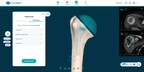 PeekMed® Unveils New Automated Orthopedic Solution for the US