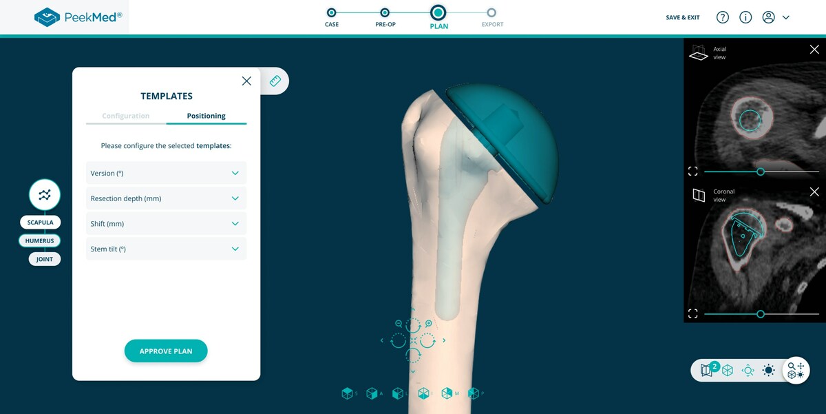 PeekMed® Unveils New Automated Orthopedic Solution for the US - Vimarsana News