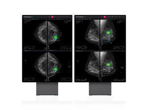 New Studies at ECR 2023 Back Clinical Efficacy of Lunit's AI Solutions in Breast Cancer Diagnosis