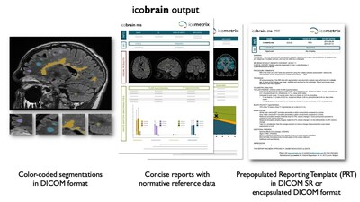 icobrain output