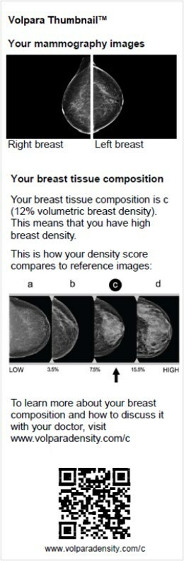 FDA Breast Density Reporting Rule is a Critical Step for Women says Volpara Health, the Leader in AI-assisted Breast Density Measurement