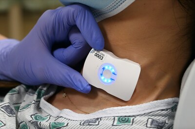El Camino Health is first health system in the world to adopt FloPatch, an innovative new technology that monitors blood flow in real time. The FDA-approved wireless, wearable Doppler ultra-sound system is placed on a patient's neck and provides a simple, fast, and consistent method for measuring changes in heart function.