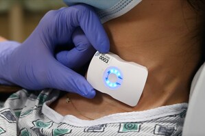 El Camino Health is first in the world to adopt FloPatch advanced ultrasound technology for sepsis management
