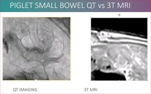 QT Imaging Announces Publication of First Whole Body Imaging Results Using Low Frequency Transmission Ultrasound