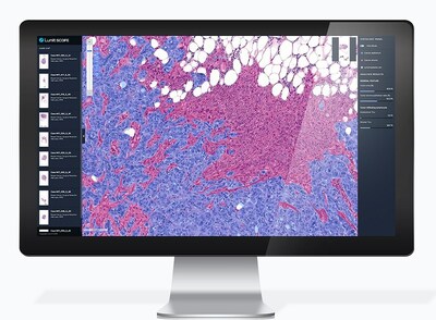 Lunit SCOPE IO, Lunit's AI biomarker platform (PRNewsfoto/Lunit)