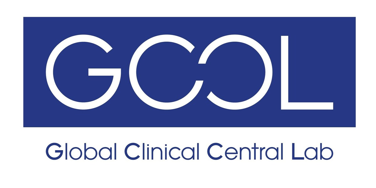 GCCL to be the first in the industry sector to adopt Lab Information Management System (LIMS) - Vimarsana News