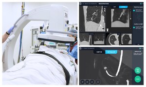 Body Vision Medical Announces Compatibility of LungVision™ Intraoperative Imaging with 2D Feature of GE HealthCare's OEC 9800, 9900, Elite, and OEC 3D C-Arms