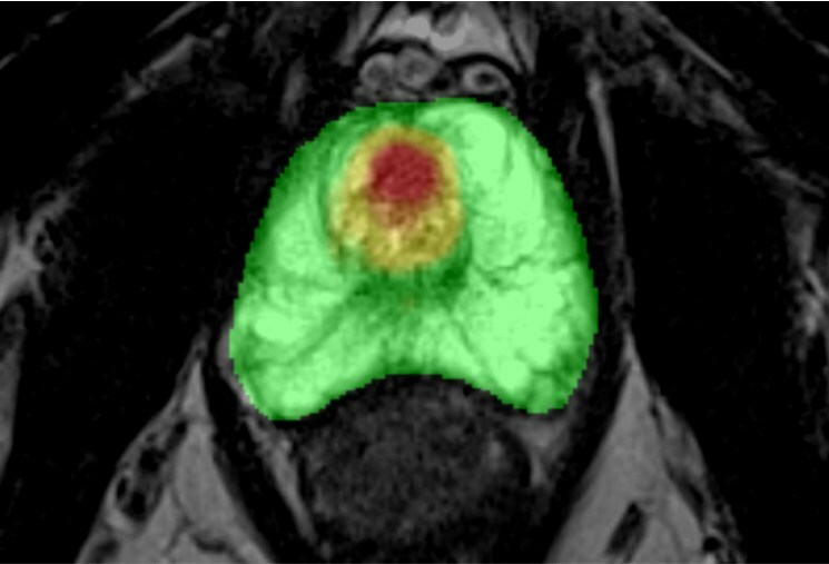 Unable to view the image, Please provide a valid URL.