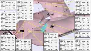 FOKUS REPORTS DIAMOND DRILL RESULTS ON RB ZONE GALLOWAY PROJECT