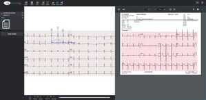 TeleRay Announces ECG Results into DICOM and EMR