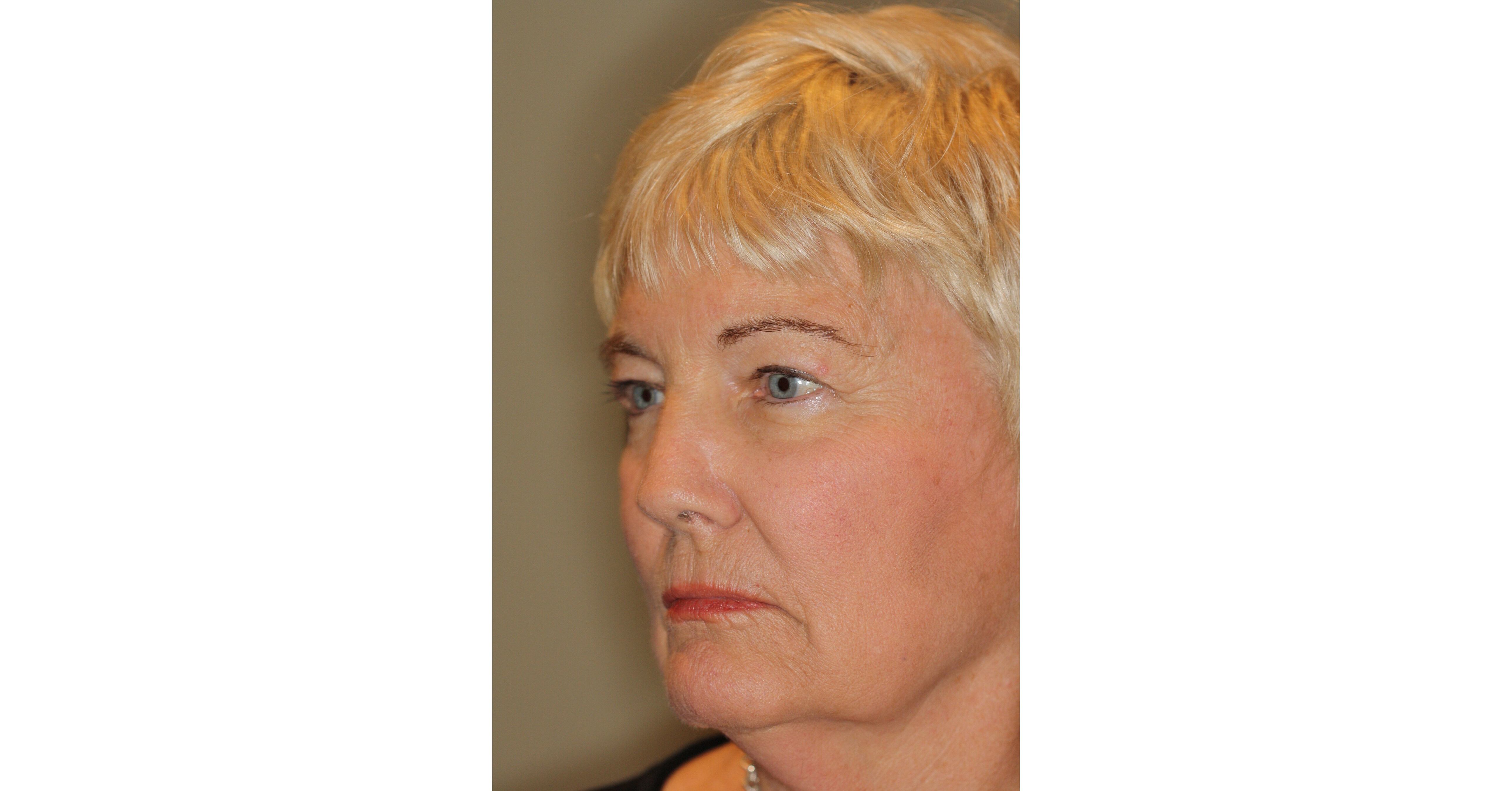 Considering Eye Surgery in Washington? You need to have more faith in