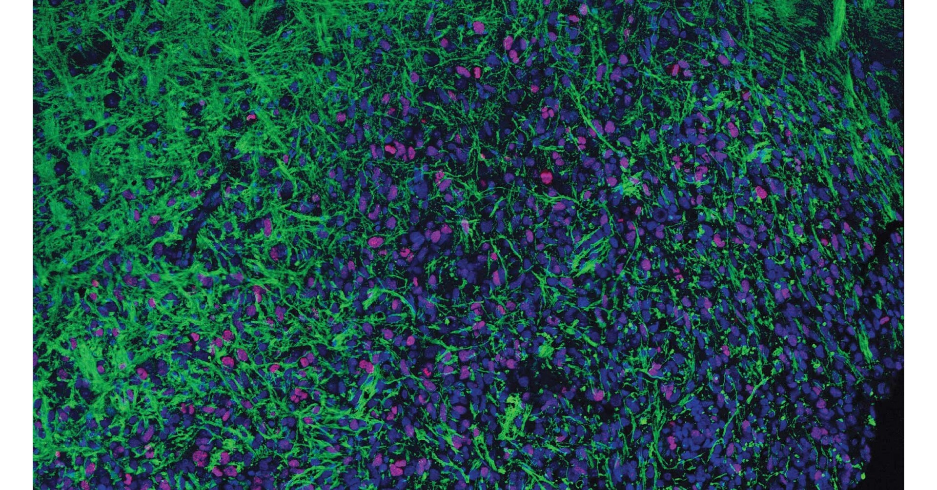 From tragedy, a potential pediatric cancer treatment From tragedy, a potential pediatric cancer treatment